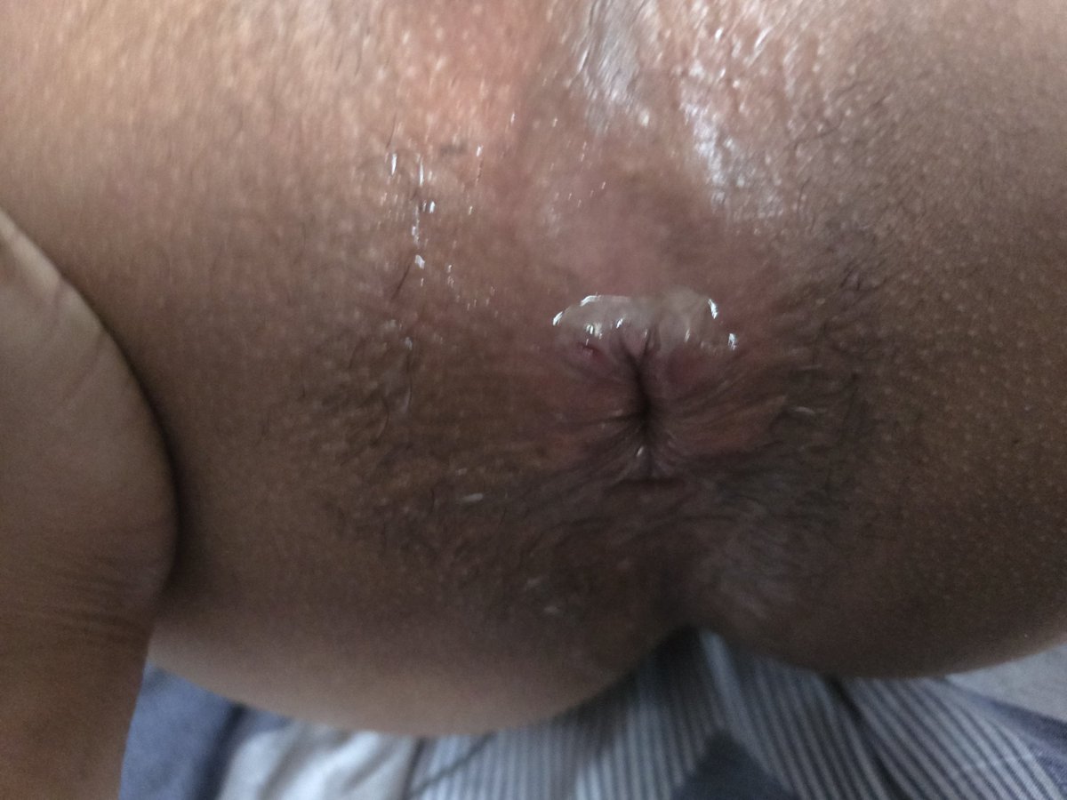ParBiPty's tweet photo. Así le dejo chorreando la leche a mi pareja luego de 2 preñadas.

#sex #chudai https://t.co/XmLMgOi4p6
