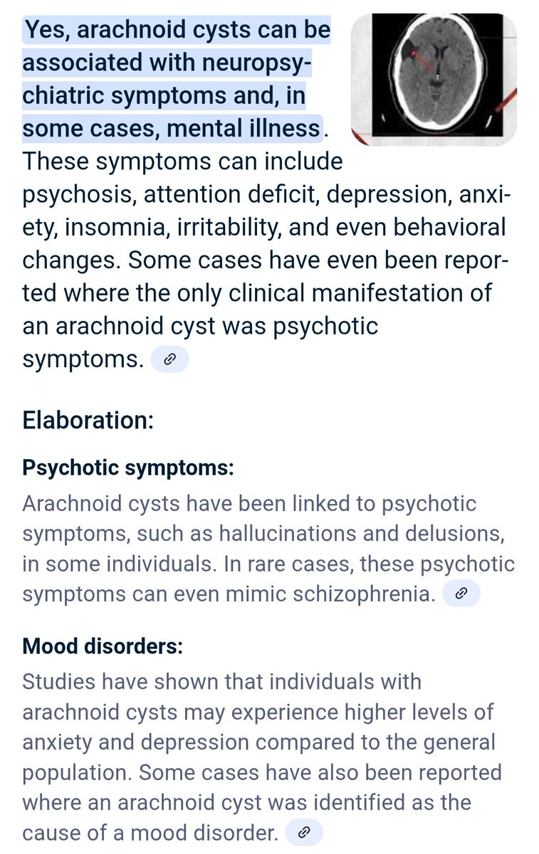 CapitalistFraud's tweet image. Arachnoid cyst / mental illness 👀
Most neurologists think arachnoid cysts are incidental on brain scans if a patient has mental illness but look what grok says. It's the same logic as brain tumour, neurosyphilis, encephalitis or anything in the brain 🧠