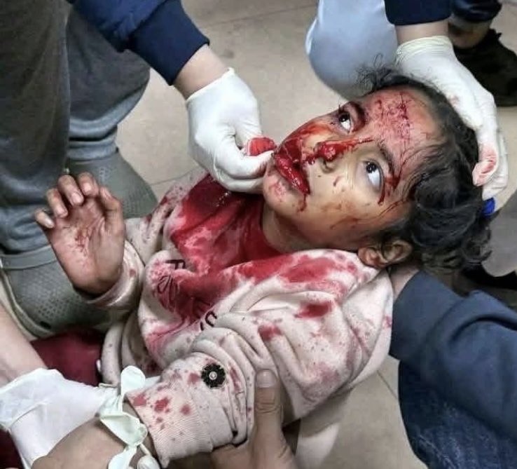 🌏 O mundo está diante da maior limpeza étnica desde a Segunda Grande Guerra Mundial. 
👉🏽 Não é combate a terrorismo,é extermínio de um povo originário, o povo Palestino. 
👉🏽 Isso precisa acabar, esse genocídio de crianças indefesas e inocentes tem que acabar. Não há honra nisso