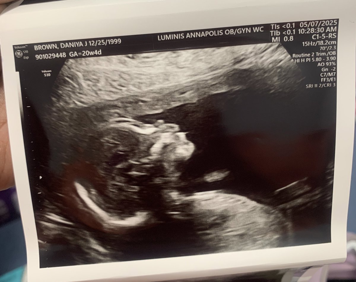 niyaaaaaa__'s tweet photo. Zion nekhi prince 💙🤴🏾 truly a gift from god https://t.co/R71N9Zo1CY