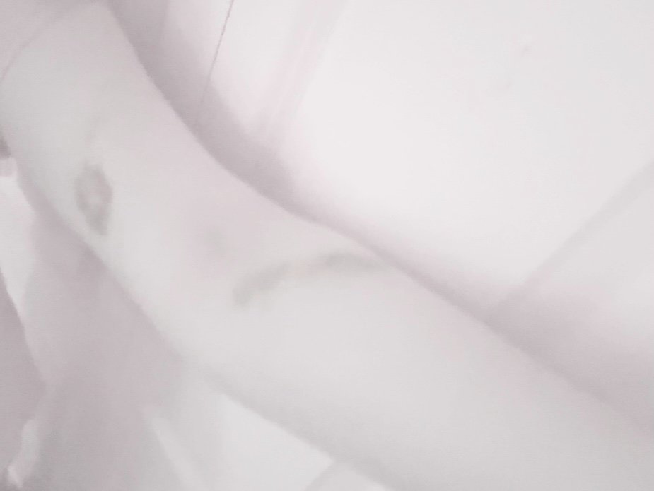 bruising is special to me ♡