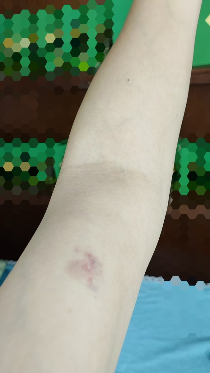 威海早啊。
我这咬人的生理性的喜欢，越来越严重了，就想在对方身上留下印记