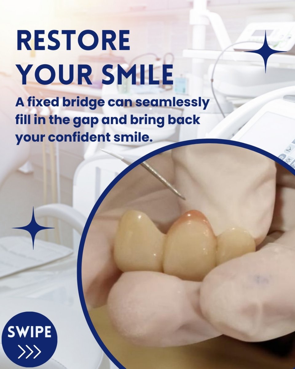 priyavermadent1's tweet image. Accidents may cause tooth loss, but don’t worry—Smile Zone Clinic has the perfect solution! Restore your smile with a fixed bridge for a natural, permanent look. 😁✨

Website: dentalclinicinwhitefield.com
☎️ +91 99006-00868

#SmileZoneClinic #ToothRestoration #FixedBridge