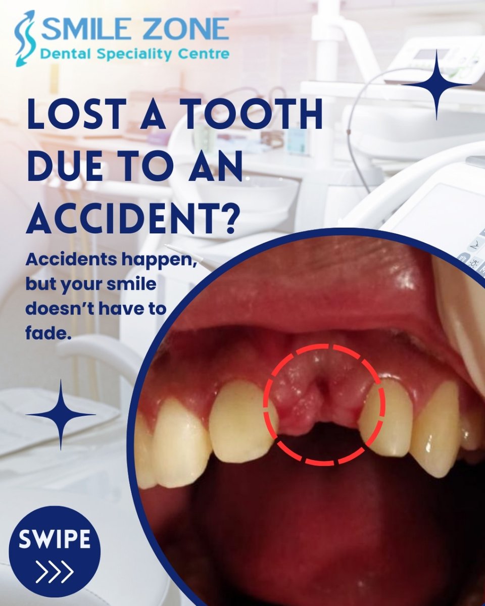 priyavermadent1's tweet image. Accidents may cause tooth loss, but don’t worry—Smile Zone Clinic has the perfect solution! Restore your smile with a fixed bridge for a natural, permanent look. 😁✨

Website: dentalclinicinwhitefield.com
☎️ +91 99006-00868

#SmileZoneClinic #ToothRestoration #FixedBridge