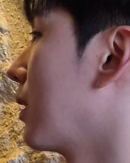 귀에 점이 자꾸만 신경쓰임😳