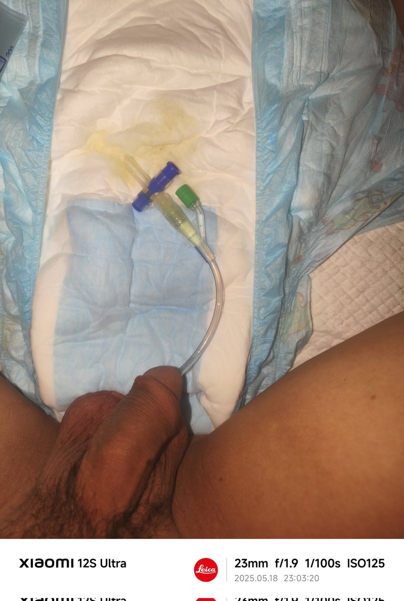 嘻嘻，又想玩啦 #导尿管 #abdl #纸尿裤 #失禁