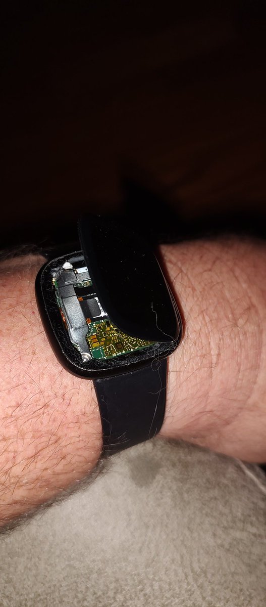 <a href="/FitbitSupport/">Fitbit Support</a> <a href="/fitbit/">fitbit</a> hey! Pretty sure this shouldn't happen. Didn't even hit it on anything, even accidentally. Just looked down and my device looks like a sprung Jack-in-the-Box!