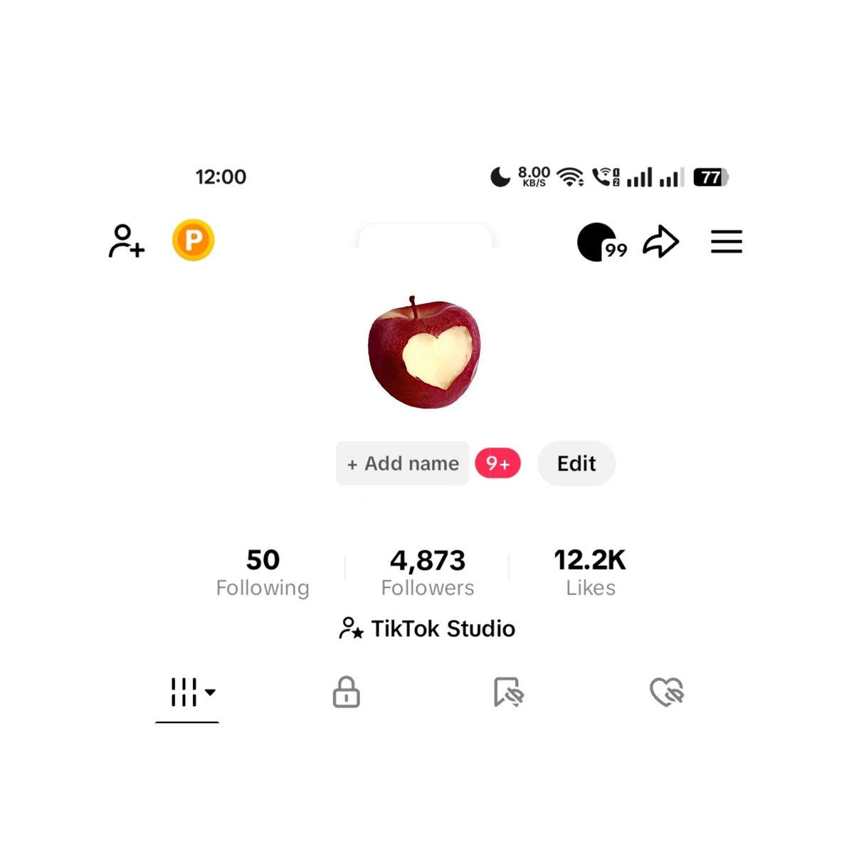 loveodette_'s tweet photo. wts these tiktok accs 

tags:
lfb ph selling twitter tiktok instagram yt accounts paypal gcash trade pp nft crypto bitcoin kpop merch seventeen for sale enhypen bts aespa twice newjeans business rt nftcommunity stan txt paymaya #NFTCommunity #zonauang #ratszone #ratzone https://t.co/kDEKIDik8j