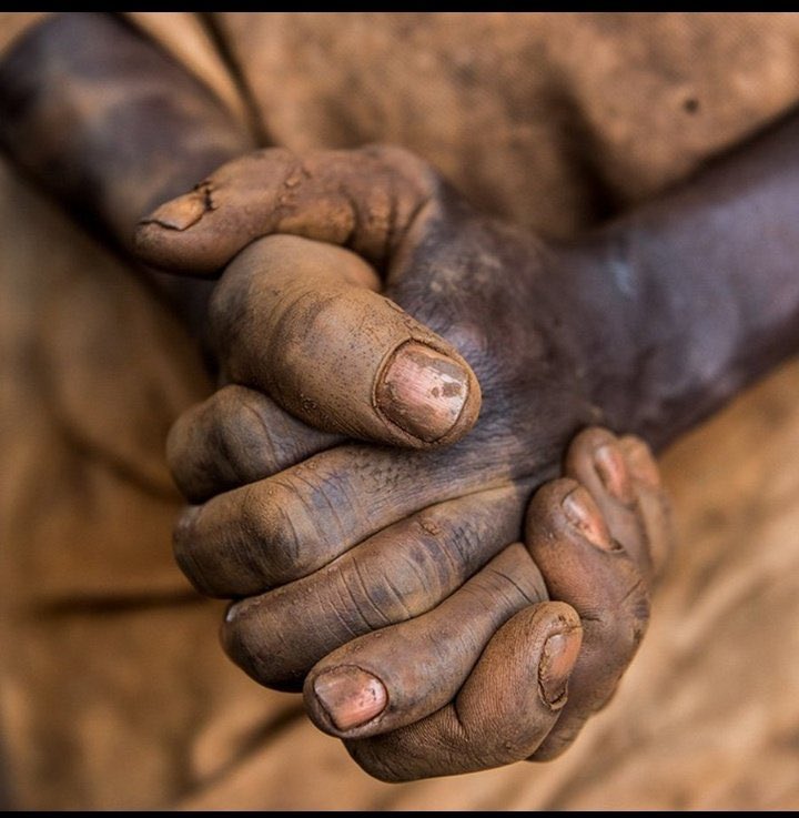 Kume kucha WAPWA tuka pambane 
Mtaji wa afya ndo muhimu gm