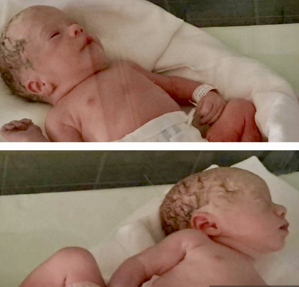 Dobri ljudi, da pozdravimo dva jako friška Života koji nakon duge borbe odmaraju i poručuju: ako je život borba onda ne odustaj. Pobeđuj! 
Samo tako Lepote, dobro došle u nove pobede 💪💪!