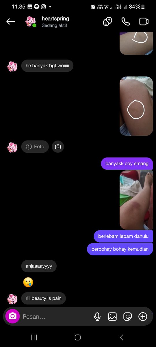 nottitinnn's tweet photo. abis ngepap banyak lebam di kaki sama tangan, dan yapp buat punya body bagus harus bersakit2 dahulu 🙊 https://t.co/tBcGO8Trum