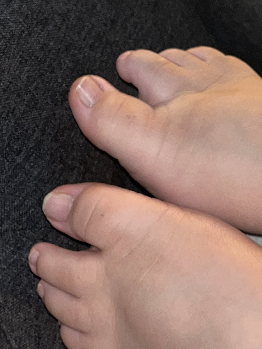 LittlestPinkyy's tweet photo. Thinking of getting a pedi soon, what color should I get? 🤔 🎨 #pedicure #toenail #whatcolor https://t.co/zjUBTQdiI6