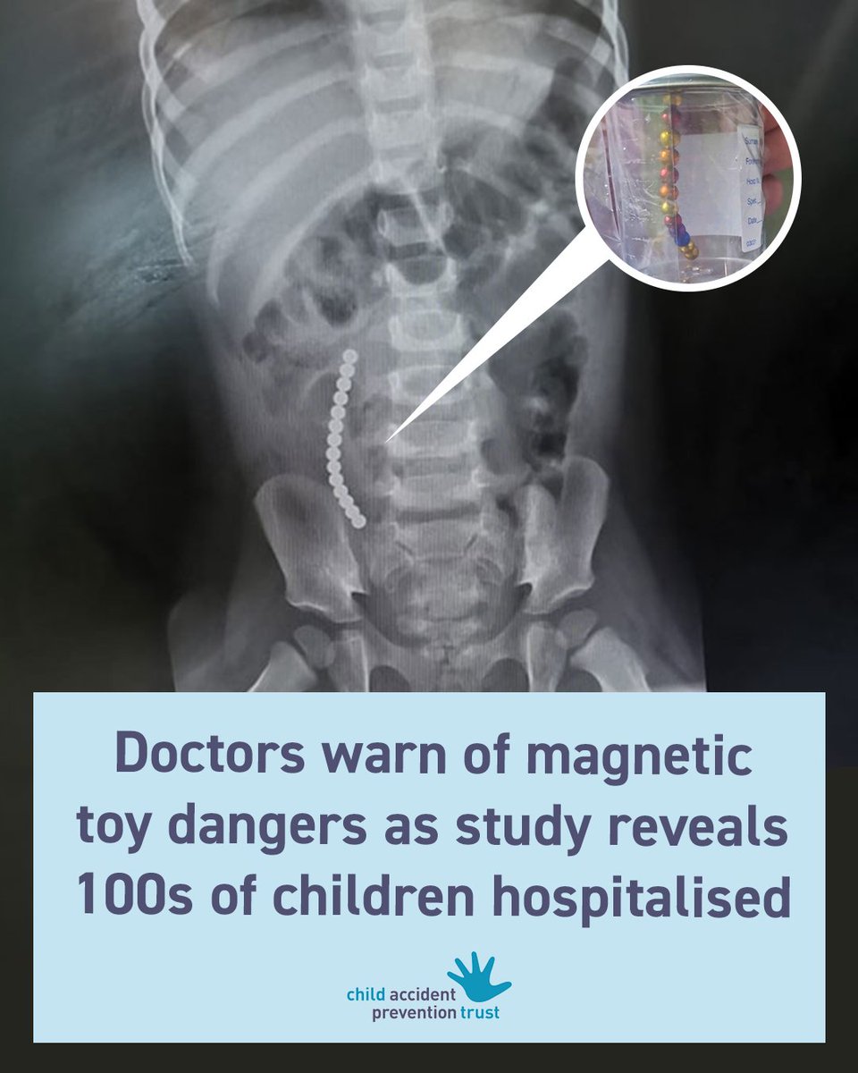 Child Accident Prevention Trust - CAPT Charity (@captcharity) on Twitter photo Doctors are warning parents about the dangers of magnets as new data shows that hundreds of children in the UK have been hospitalised after accidentally swallowing them.
Learn more: capt.org.uk/doctors-warn-o…
<a href="/unisouthampton/">University of Southampton</a> <a href="/SouthamptonBRC/">NIHR Southampton BRC</a> <a href="/SotonChildHosp/">Southampton Children's Hospital</a> Doctors are warning parents about the dangers of magnets as new data shows that hundreds of children in the UK have been hospitalised after accidentally swallowing them.
Learn more: capt.org.uk/doctors-warn-o…
<a href="/unisouthampton/">University of Southampton</a> <a href="/SouthamptonBRC/">NIHR Southampton BRC</a> <a href="/SotonChildHosp/">Southampton Children's Hospital</a>