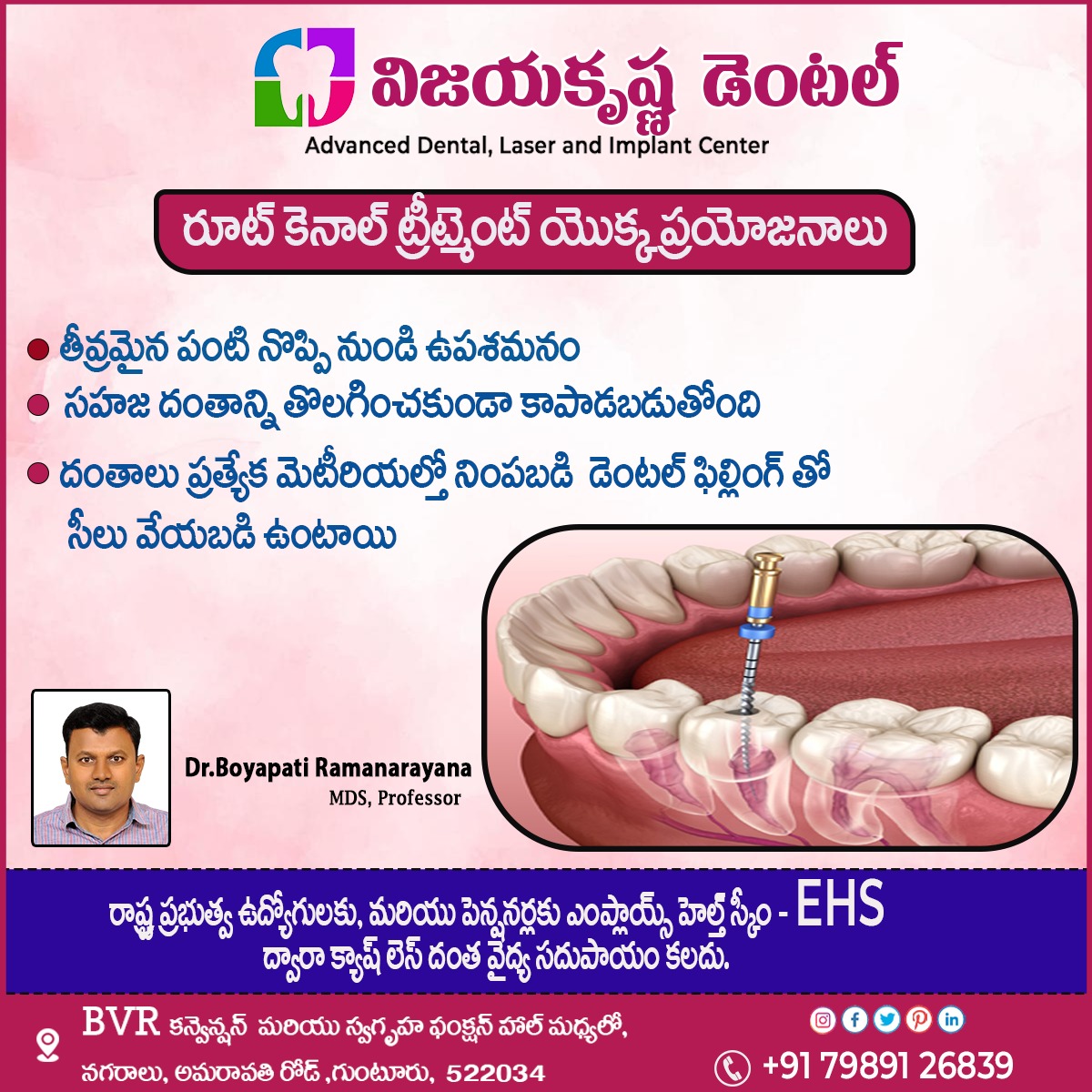 Vijayakris32331's tweet image. రూట్ కెనాల్ ట్రీట్మెంట్ యొక్క ప్రయోజనాలు
📞+91 79891 26839
#pedodental #bleedinggumssymptoms #fixedteeth #CrookedTeeth #throughorthodontic #rootcanal #rootcanaltreatment #drboyapatiramanarayana #besttreatment #toothreplacement #bestdentalcare #vijayakrishnadental