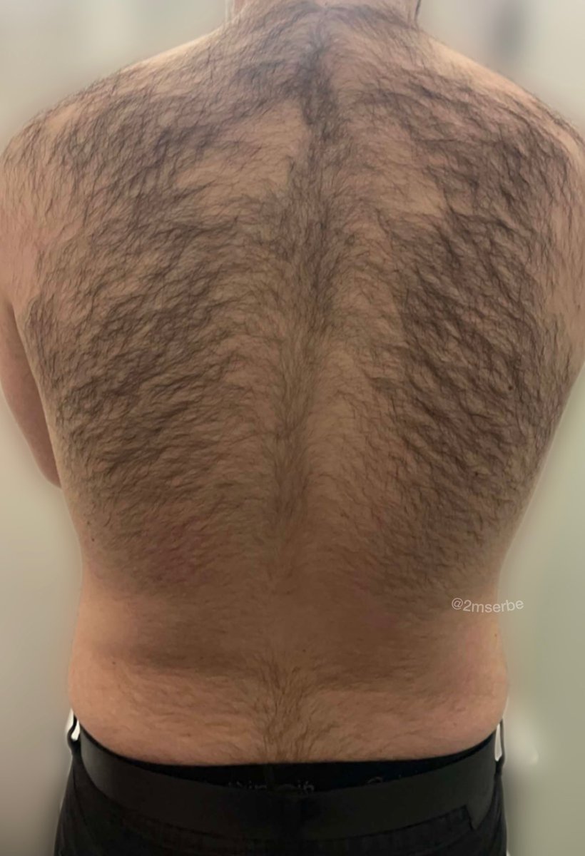 2mserbe's tweet photo. Yes, im very hairy

#hairy #gay #bi #serbia #gayserbia #biserbia #big #gaybalkan #balkan #2m #sex #sexy https://t.co/oirmwT6Zp6