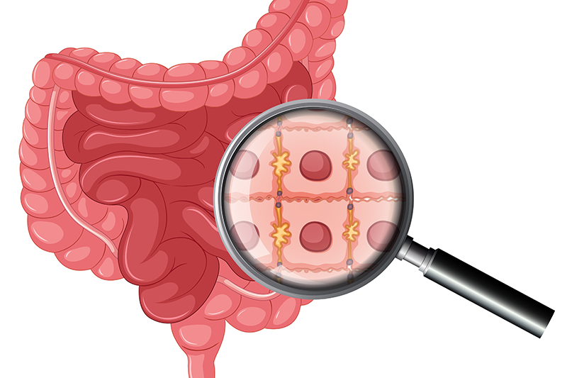 curiosidadafoco's tweet image. #HojeEDiaMundial da Doença Inflamatória Intestinal

Aumentando a conscientização sobre condições como a Doença de Crohn e a Retocolite Ulcerativa. #DII #SaúdeIntestinal