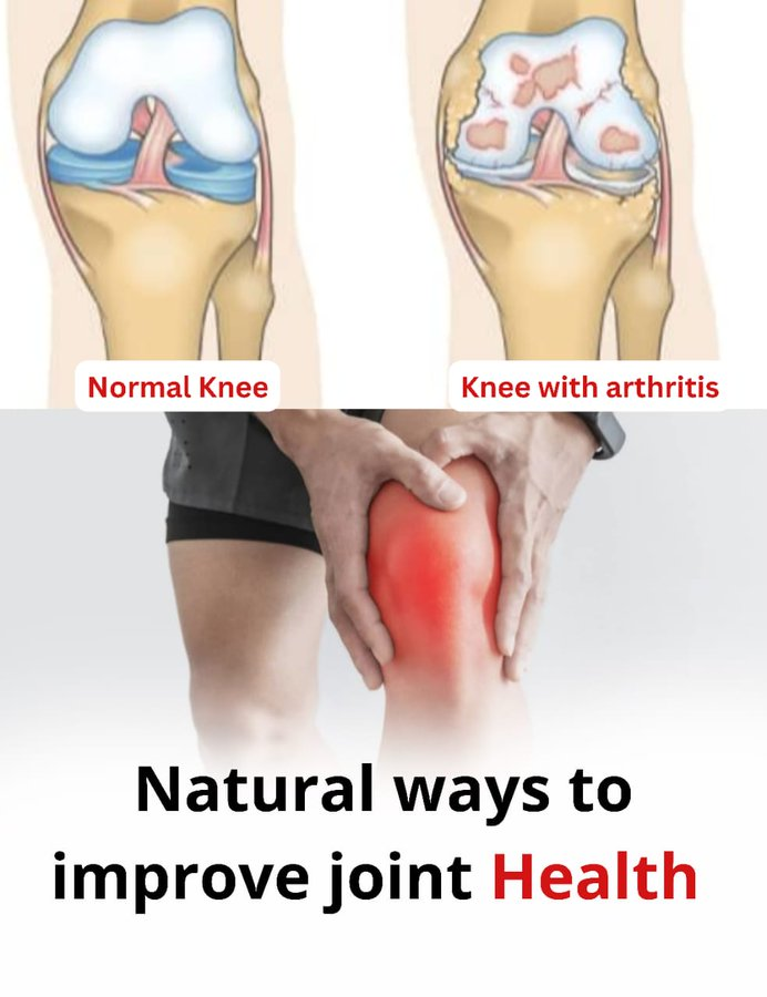 Eklem ağrısı “sadece yaşla” ilgili değildir.
Bu, vücudunuzun alarm vermesidir:
• Yedikleriniz size karşı savaşıyor olabilir!
• Dinlenmeniz işe yaramıyor mu?
• Hareketleriniz acı mı veriyor?
İşte eklem ağrısı hakkında bilmeniz gerekenler (ve ilaçsız nasıl iyileşebileceği):🧵