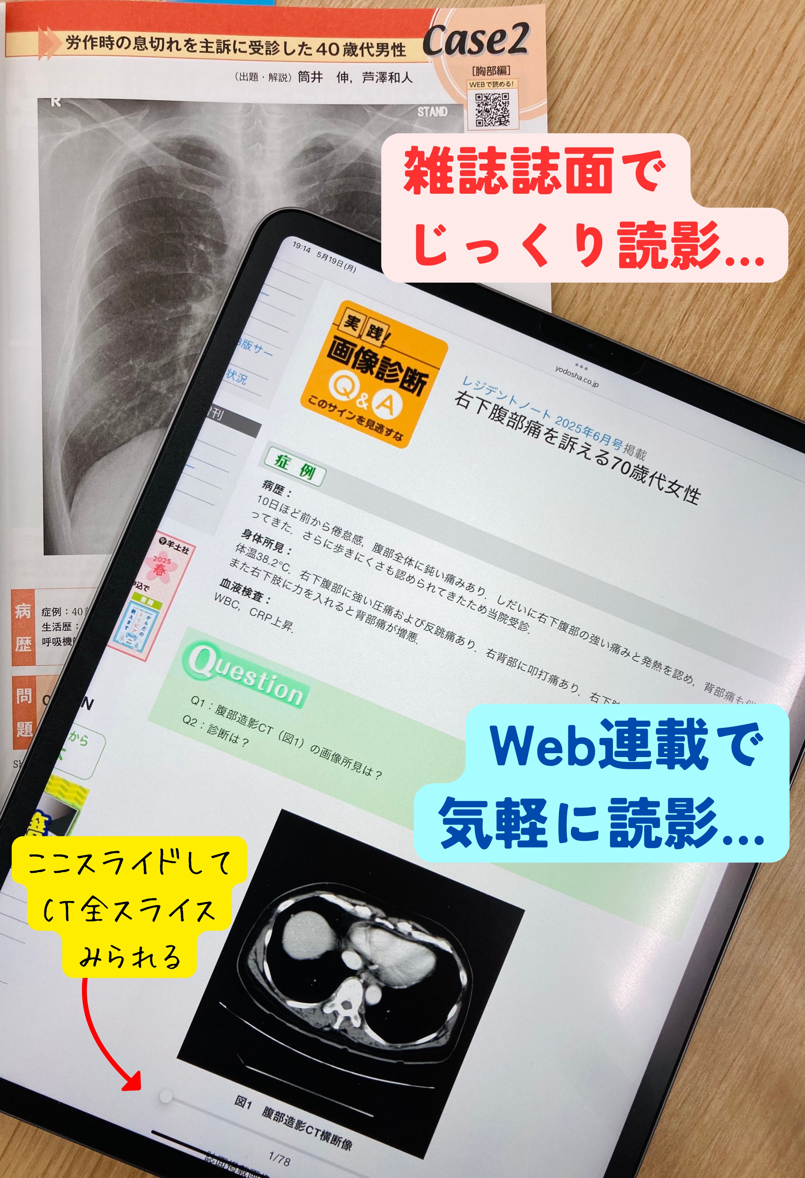 レジデントノート定期購読のご案内｜プライマリケアと救急を中心