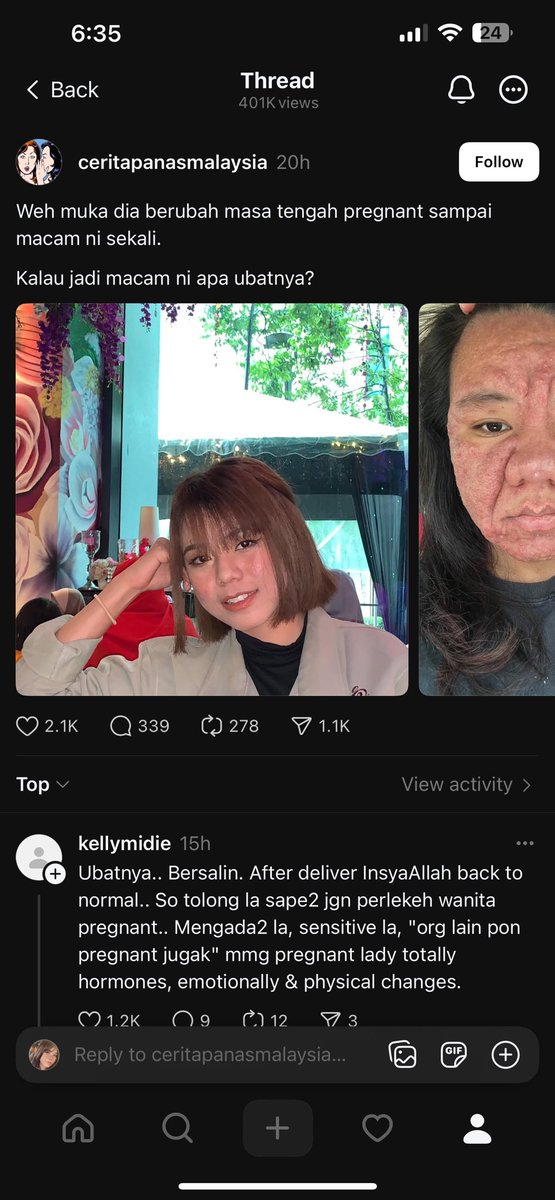 ayyitslala's tweet photo. Please report thread ni https://t.co/4yMwlp0QxV . I tak bagi consent pun untuk dia post macam ni, kalau dia post to educate i okay. Ni for engagement and mengundang orang cakap buruk pasal i. https://t.co/U68WR3mhe8