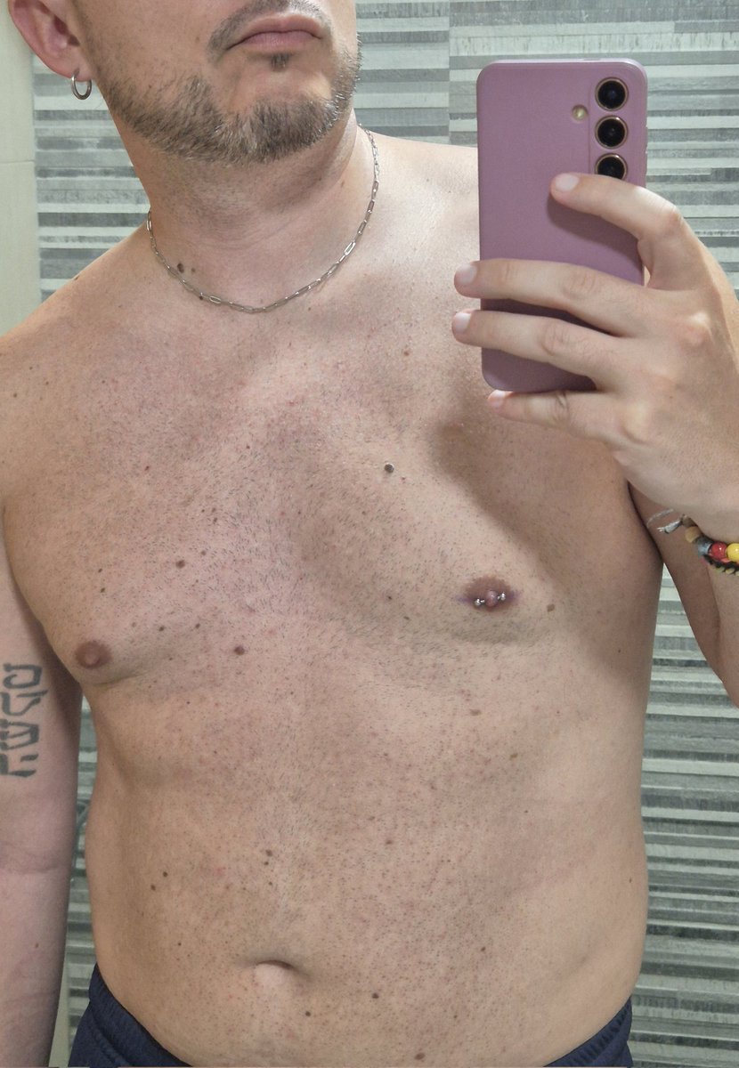 risketis's tweet photo. No os he enseñado el nuevo piercing... https://t.co/aiDyWBdsjW