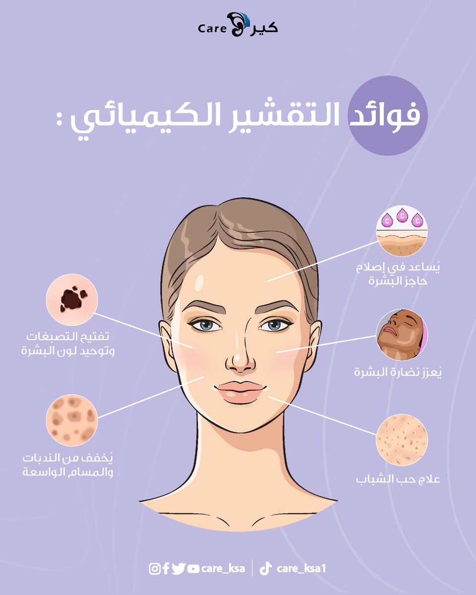 من الإجراءات الجلدية الفعالة لتجديد البشرة وتحسين ملمسها ومظهرها العام. التقشير الكيميائي يُنفذ تحت إشراف طبي لضمان الأمان والفعالية. 🙏💜

#عيادات_كير
#مركز_كير
#تقشير