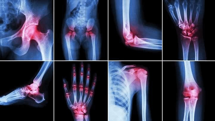 كل شخص يزيد عمره عن 35 عامًا يلقي باللوم على الشيخوخة في تصلب المفاصل وألمها.

اتضح أن الأمر لا يتعلق بالعمر.... بل يتعلق بسنوات من الإهمال.

إليك 8 حلول بسيطة لإعادة بناء مفاصلك والشعور بعمر 25 عاما مرة أخرى 1 :