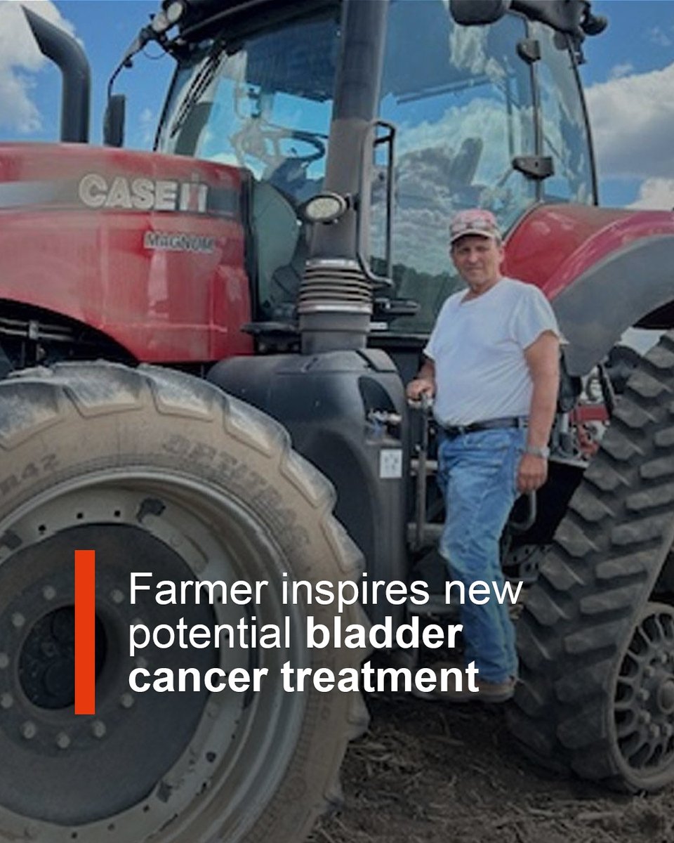 In 2023, Craig Smith was diagnosed with metastatic bladder cancer that spread to his spine. He underwent surgery, having his bladder, prostate and 36 lymph nodes removed. His case spurred a clinical trial testing this aggressive approach.
⁠
Learn more: mayocl.in/4mCxS4G