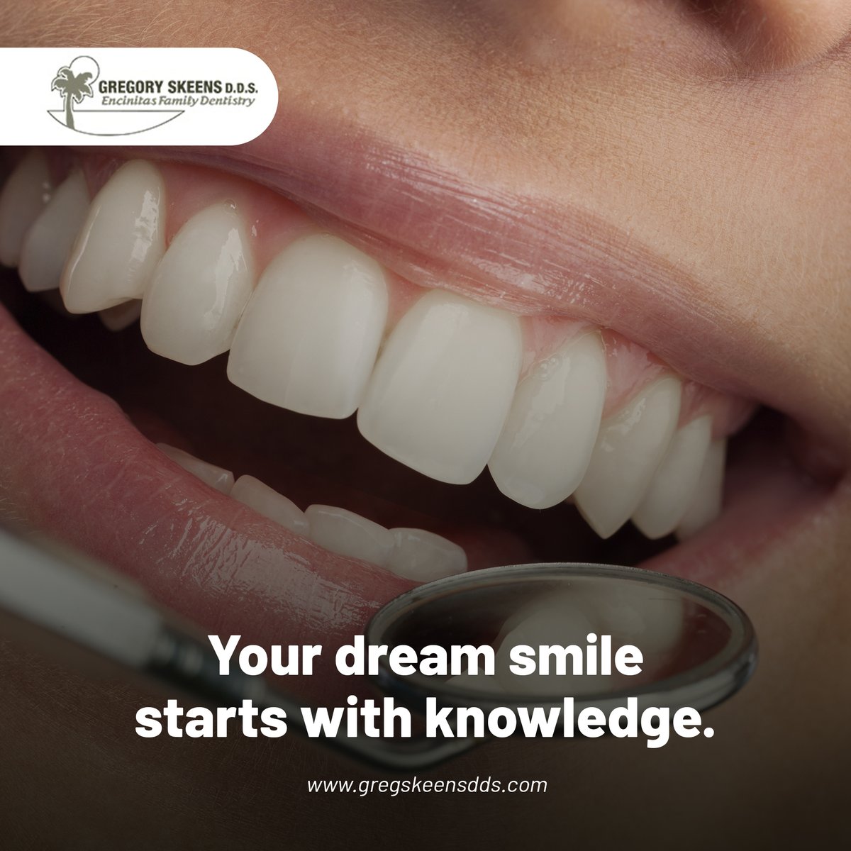 Considering a smile makeover? 😃 Our latest blog explains cosmetic dentistry options from veneers to whitening.

Read "Understanding Cosmetic Dentistry" here: gregskeensdds.com/blog  

#CosmeticDentistry #EncinitasDentist #SmileMakeover #CosmeticDentist