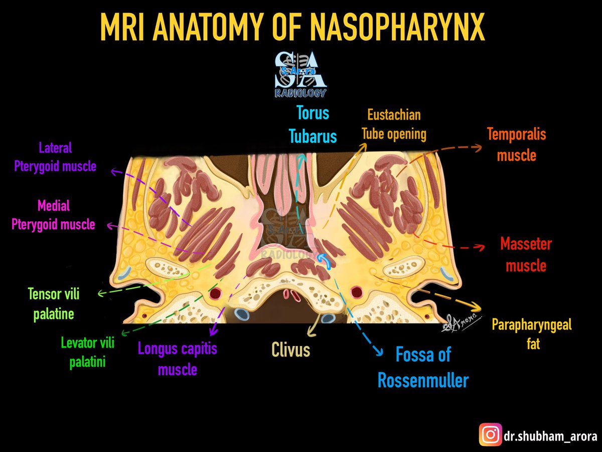 Dr_S_Arora's tweet image. Slide on MRI anatomy of nasopharynx.
#medX #Radiology
