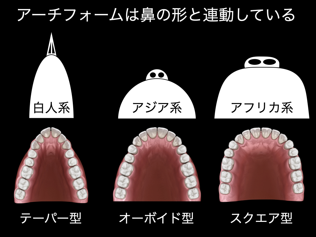 日本人の矯正治療というのは大前提として
「骨格が違いすぎるから白人のマネは無理」
というところからスタートします。
まずはこれを理解しないと海外からの情報を鵜呑みにしてしまいます。
この大前提を理解していない、知りもしないという歯科医師があまりに多いというのがいまだに問題なのです。
