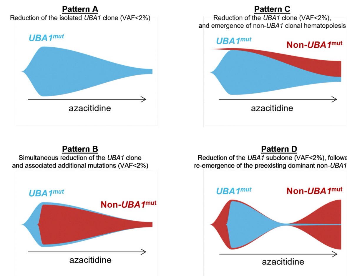 Emma M. Groarke (@emmamgroarke) on Twitter photo Congrats to FRENVEX for their study on azacitadine in #VEXAS led by <a href="/thibault_comont/">Thibault Comont, MD</a> in <a href="/BloodJournal/">Blood Journal</a>. Confirmed inflammatory & hematologic responses in >50%. Molecular responses in >2/3rds! Toxicity common especially in first 3 cycles. ashpublications.org/blood/article/… <a href="/mekinian2/">Arsene Mekinian</a> Congrats to FRENVEX for their study on azacitadine in #VEXAS led by <a href="/thibault_comont/">Thibault Comont, MD</a> in <a href="/BloodJournal/">Blood Journal</a>. Confirmed inflammatory & hematologic responses in >50%. Molecular responses in >2/3rds! Toxicity common especially in first 3 cycles. ashpublications.org/blood/article/… <a href="/mekinian2/">Arsene Mekinian</a>