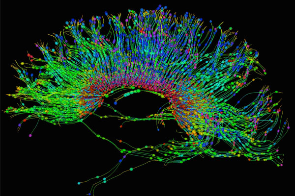 Mayo Clinic Med Ed (@mayomeded) on Twitter photo Brain tumor specialists, join us in Florida (or via livestream) for Updates in Neuro Oncology on Sept. 12-13. This advanced course brings together Mayo Clinic experts to delve into cutting-edge research, therapies, and clinical practices. mayocl.in/4doEOOn <a href="/MayoClinicNeuro/">Mayo Clinic Neuro</a> Brain tumor specialists, join us in Florida (or via livestream) for Updates in Neuro Oncology on Sept. 12-13. This advanced course brings together Mayo Clinic experts to delve into cutting-edge research, therapies, and clinical practices. mayocl.in/4doEOOn <a href="/MayoClinicNeuro/">Mayo Clinic Neuro</a>