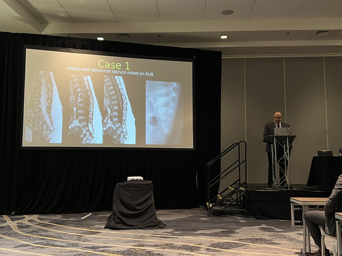 American Society of Pediatric Neuroradiology (@the_aspnr) on Twitter photo 🔥Get Your Game On - Name That Syndrome🔥 Focus Session at #ASNR25 just getting started! <a href="/MirskyDavid/">David Mirsky</a> <a href="/WmOBrienDO/">William T. O'Brien, DO 🧠🩻</a> <a href="/SusanPalasis/">Susan Palasis</a> <a href="/draash/">Aashim Bhatia, M.D., M.S.</a> <a href="/hishamdahmoush/">Hisham Dahmoush</a>
#pedrad #pedineurorad 🔥Get Your Game On - Name That Syndrome🔥 Focus Session at #ASNR25 just getting started! <a href="/MirskyDavid/">David Mirsky</a> <a href="/WmOBrienDO/">William T. O'Brien, DO 🧠🩻</a> <a href="/SusanPalasis/">Susan Palasis</a> <a href="/draash/">Aashim Bhatia, M.D., M.S.</a> <a href="/hishamdahmoush/">Hisham Dahmoush</a>
#pedrad #pedineurorad