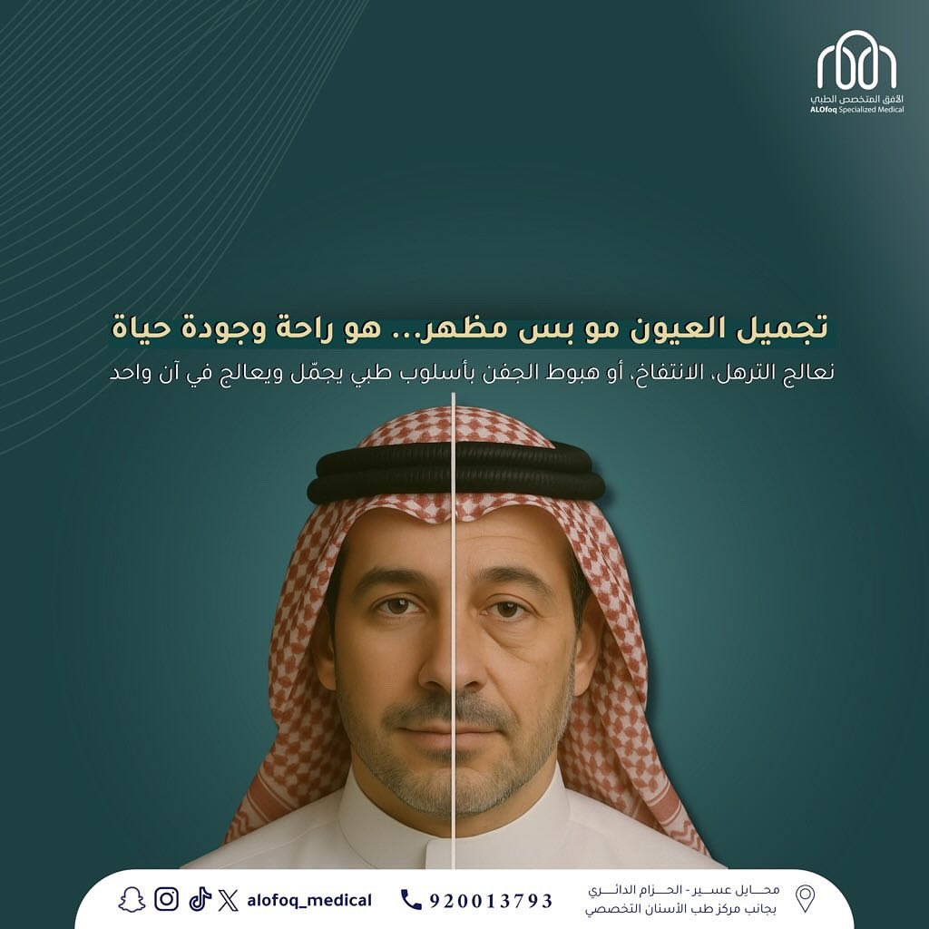 خذ الخطوة إللي تفرق وأحجز استشارتك الآن 👀💉✨

 في #الأفق_المتخصص_الطبي بـ #محايل_عسير 
☎️920013793

#تجميل_العيون #الجفون_المبطنة #الجفون_المترهلة #الجفون_العلوية #الجفون_السفلية