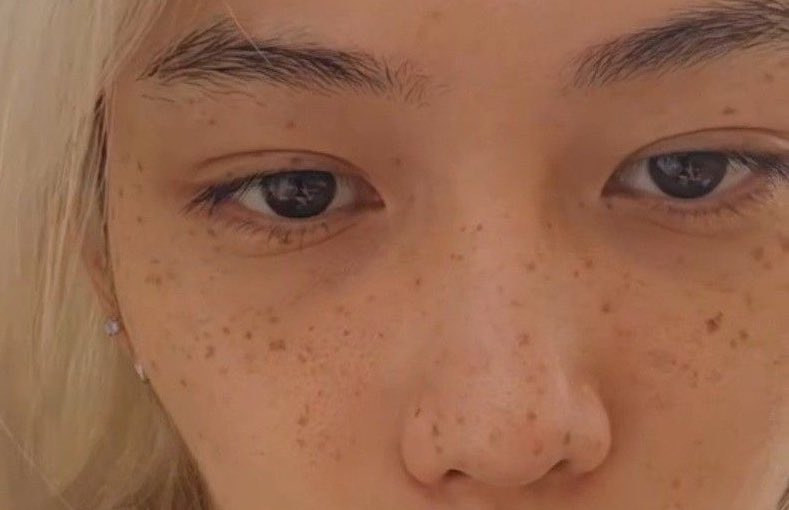 dailylixiee's tweet photo. love it so much when his beautiful freckles are super visible 💕 https://t.co/2gEUTHIBwg