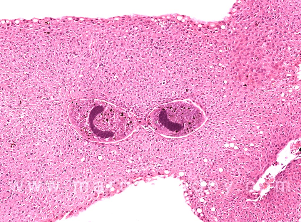 marcosgodoy1_'s tweet photo. Infección cutánea de la aleta caudal por Ichthyophthirius multifiliis.
Cutaneous infection of the tail fin by Ichthyophthirius multifiliis
https://t.co/eq37o0oU4c
#fishpathology #fishdiseases #salmondiseases #salmonpathology #fishhealth #salmonhealth #Ich #marcosgodoy https://t.co/Dwi2uoKedP