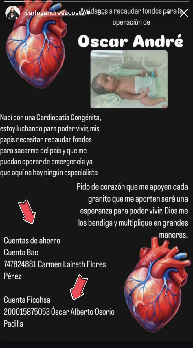 Bravo #LHTFM por contarnos el caso de Oscar André… orando por el bebé y su salud 🙏🏻  ayudemos a este hermoso bebé 🙏🏻