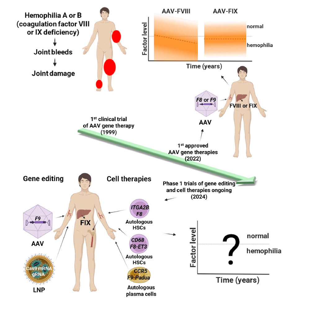 Cell Press (@cellpressnews) on Twitter photo Gene therapy for hemophilia – From basic science to first approvals of “one-and-done” therapies
hubs.li/Q03mqMJl0
Special issue highlight: Celebrating 25 years of Molecular Therapy
<a href="/MolTherapy/">Molecular Therapy</a> @asgctherapy <a href="/RKaczmarekDr/">Radoslaw Kaczmarek</a> Gene therapy for hemophilia – From basic science to first approvals of “one-and-done” therapies
hubs.li/Q03mqMJl0
Special issue highlight: Celebrating 25 years of Molecular Therapy
<a href="/MolTherapy/">Molecular Therapy</a> @asgctherapy <a href="/RKaczmarekDr/">Radoslaw Kaczmarek</a>