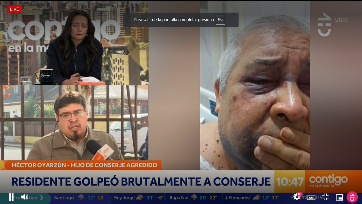 Themistocleste's tweet photo. Martin de los Santos, golpeó a un pobre viejo que trabajaba de conserje

Un maldito conchesumadre, si lo ve en las calles de #Pichilemu déjelo sin poder caminar y tírelo al mar

Esa lacra estará siempre protegida por la plata de sus padres

#ContigoCHV 

https://t.co/sDBarqai7t https://t.co/RSAKNJRhjh