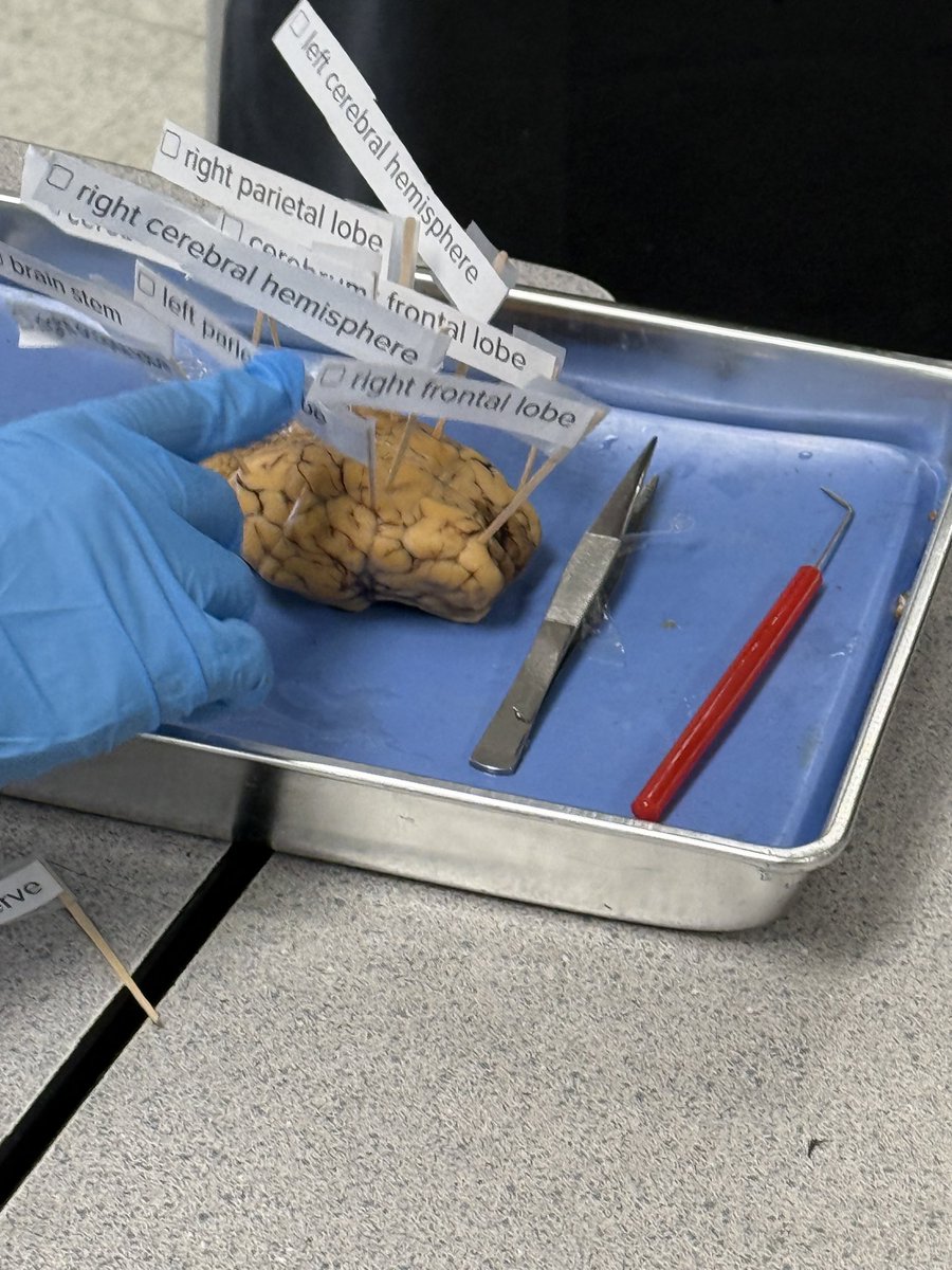 Jessica Estrada (@jestrada_cms) on Twitter photo The culmination of what our amazing students have learned! Hands on practice with labeling of the different parts of the brain. <a href="/jandazola_cms/">W.E. Clarke Math & Robotics</a> <a href="/WalterEClarkeMS/">Daniela Palmer</a> <a href="/GThomas_SEC/">George C. Thomas</a> <a href="/VDeAvila_SEC/">Veronica De Avila</a> #TeamSISD The culmination of what our amazing students have learned! Hands on practice with labeling of the different parts of the brain. <a href="/jandazola_cms/">W.E. Clarke Math & Robotics</a> <a href="/WalterEClarkeMS/">Daniela Palmer</a> <a href="/GThomas_SEC/">George C. Thomas</a> <a href="/VDeAvila_SEC/">Veronica De Avila</a> #TeamSISD