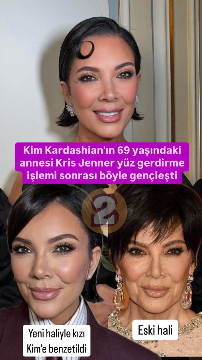 2_sayfaofficial's tweet photo. Kim Kardashian'ın 69 yaşındaki annesi Kris Jenner yüz gerdirme işlemi sonrası böyle gençleşti https://t.co/sdzQhJyo7M