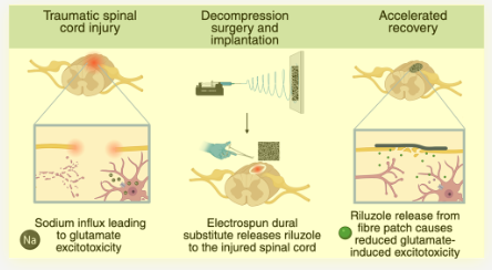 RCSI TERG (@tissueengdublin) on Twitter photo Another publication today! Congratulations to Bhavana Pulipaka, <a href="/AdrianDervan/">Adrian Dervan</a> & <a href="/fjobrien/">Prof. Fergal O'Brien</a> on the publication of the article 'Neuroprotective Riluzole-Releasing Electrospun Implants for Spinal Cord Injury' in Molecular Pharmaceutics <a href="/ACSPublications/">ACS Publications</a>!: pubs.acs.org/doi/full/10.10… Another publication today! Congratulations to Bhavana Pulipaka, <a href="/AdrianDervan/">Adrian Dervan</a> & <a href="/fjobrien/">Prof. Fergal O'Brien</a> on the publication of the article 'Neuroprotective Riluzole-Releasing Electrospun Implants for Spinal Cord Injury' in Molecular Pharmaceutics <a href="/ACSPublications/">ACS Publications</a>!: pubs.acs.org/doi/full/10.10…