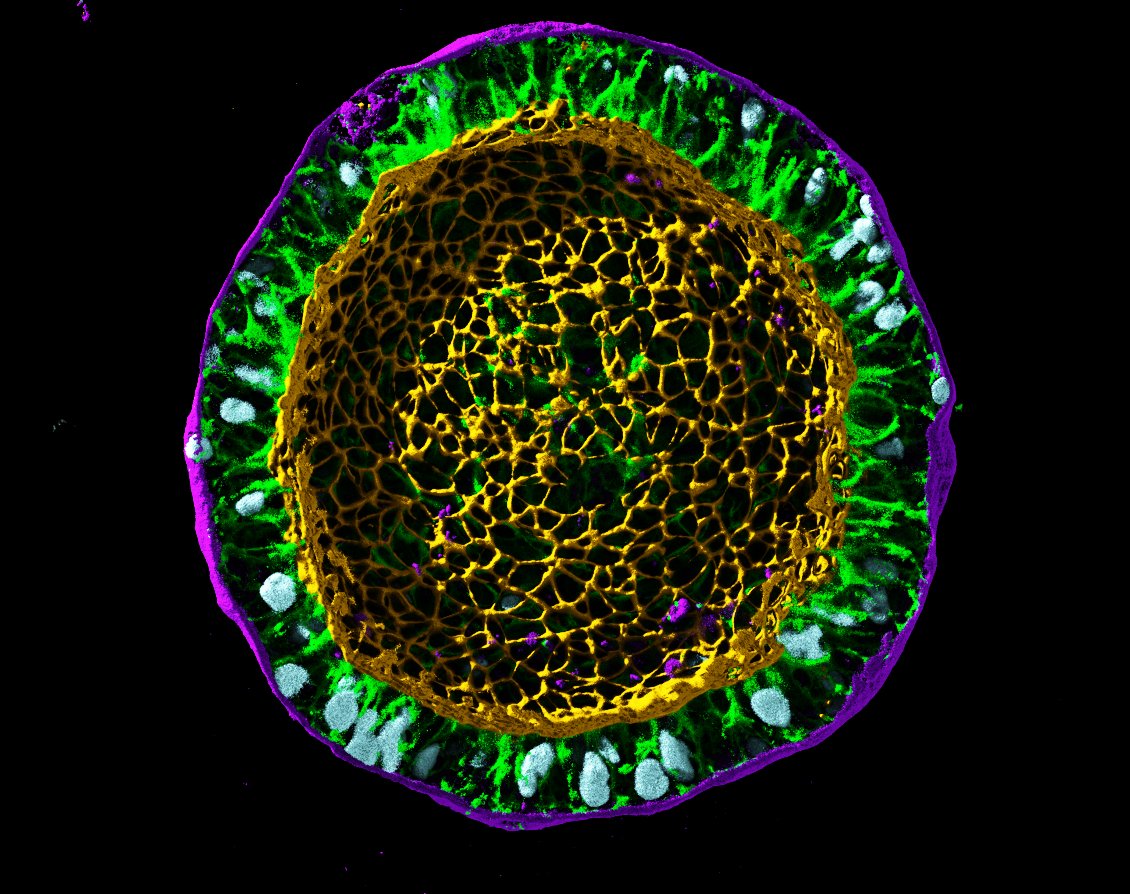 Science in Seattle (@science_seattle) on Twitter photo The <a href="/AllenInstitute/">Allen Institute</a> is embarking on a 10-year project called #CellScapes to devise a new language using mathematics to capture how cells move, organize, and change their properties. đź¦
Learn more: bit.ly/3H0StiH The <a href="/AllenInstitute/">Allen Institute</a> is embarking on a 10-year project called #CellScapes to devise a new language using mathematics to capture how cells move, organize, and change their properties. đź¦
Learn more: bit.ly/3H0StiH