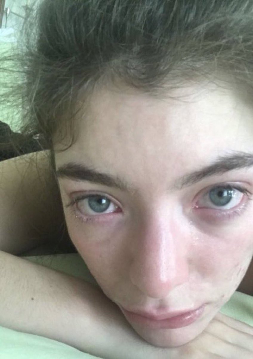 ًpics of lorde (@satnsl) on Twitter photo 