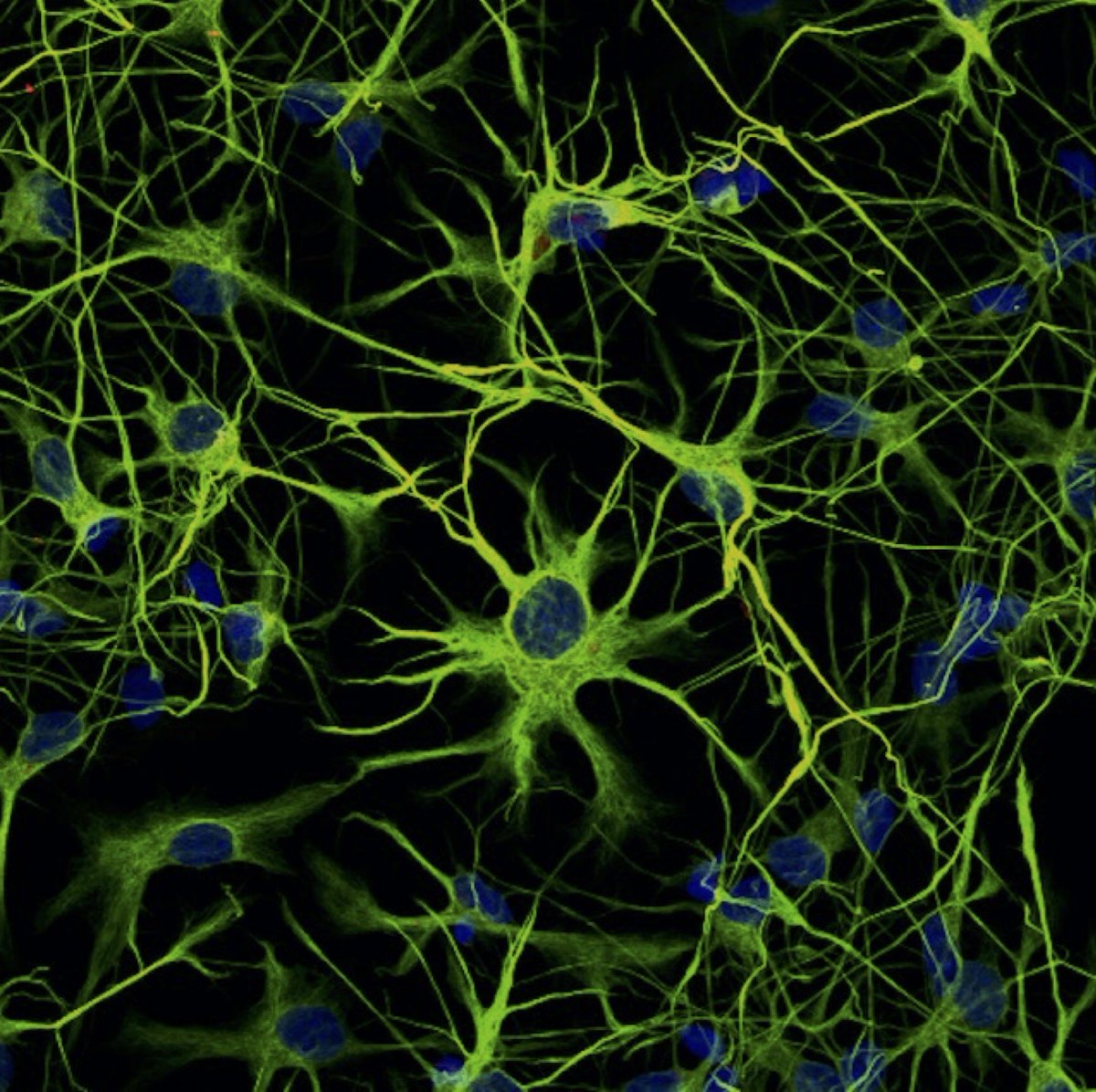 CZI Science (@cziscience) on Twitter photo “I am genuinely thrilled about the potential of this project to forge new understanding + enhance metabolic health across tissues.”
<a href="/AWartiovaara/">Anu Suomalainen Wartiovaara</a> + <a href="/PekkaKatajisto/">Pekka Katajisto</a> are working together to establish broad principles of metabolism that could inform future research “I am genuinely thrilled about the potential of this project to forge new understanding + enhance metabolic health across tissues.”
<a href="/AWartiovaara/">Anu Suomalainen Wartiovaara</a> + <a href="/PekkaKatajisto/">Pekka Katajisto</a> are working together to establish broad principles of metabolism that could inform future research