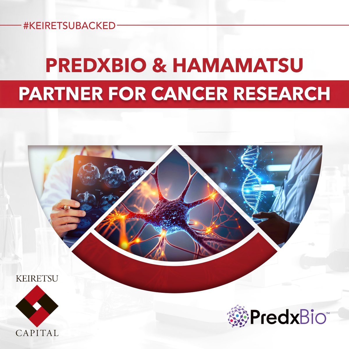 PredxBio partners with Hamamatsu Photonics to advance cancer immuno-oncology. Combining MoxiePlex &amp; SpaceIQ, researchers can now gain faster insights into immune cell behavior, pathways, and biomarker grouping. Learn more: tinyurl.com/ya6nf4e5

#cancerresearch #medtech
