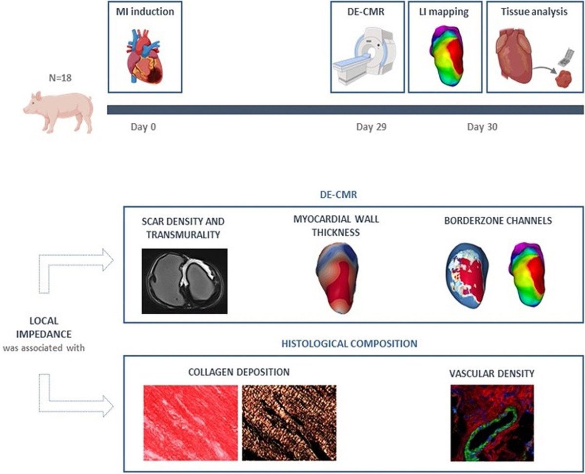 Victoria Delgado (@vdelgadogarcia) on Twitter photo Tissue Characteristics Underlying Endocardial Local Impedance Subtypes in Chronic myocardial Infarction - Heart Rhythm 👉heartrhythmjournal.com/article/S1547-…
Kudos to <a href="/AranyoJulia/">Julia Aranyó</a> for this fantastic experimental work <a href="/iCorGTrias/">L'Institut del Cor del Germans Trias</a> <a href="/HRSonline/">Heart Rhythm Society</a> <a href="/GTRecerca/">IGTP</a> <a href="/ritmo_SEC/">Asociación del Ritmo Cardiaco</a> <a href="/EHRAPresident/">EHRAPresident</a> <a href="/hgermanstrias/">Hosp. Germans Trias</a> Tissue Characteristics Underlying Endocardial Local Impedance Subtypes in Chronic myocardial Infarction - Heart Rhythm 👉heartrhythmjournal.com/article/S1547-…
Kudos to <a href="/AranyoJulia/">Julia Aranyó</a> for this fantastic experimental work <a href="/iCorGTrias/">L'Institut del Cor del Germans Trias</a> <a href="/HRSonline/">Heart Rhythm Society</a> <a href="/GTRecerca/">IGTP</a> <a href="/ritmo_SEC/">Asociación del Ritmo Cardiaco</a> <a href="/EHRAPresident/">EHRAPresident</a> <a href="/hgermanstrias/">Hosp. Germans Trias</a>