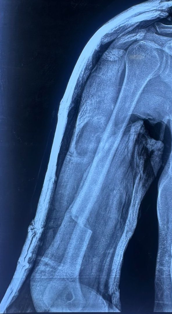 Haseeb Gani tweet media