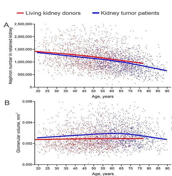 markusathome (@markusathome) on Twitter photo KIDNEY AGING and CHRONIC KIDNEY DISEASE - Another Perspective by Drs. <a href="/GlassockJ/">Richard J. Glassock</a>, <a href="/PStoneOftheYear/">Pierre Delanaye</a> et al.
academic.oup.com/ndt/article/do…
Watch our YouTube Webinar about
The Aging Kidney: Physiological Changes - <a href="/GlassockJ/">Richard J. Glassock</a>, Prof. Schäffner, <a href="/ToralfMelsom/">Toralf Melsom</a>
youtu.be/c5lhQupBjc8?si… KIDNEY AGING and CHRONIC KIDNEY DISEASE - Another Perspective by Drs. <a href="/GlassockJ/">Richard J. Glassock</a>, <a href="/PStoneOftheYear/">Pierre Delanaye</a> et al.
academic.oup.com/ndt/article/do…
Watch our YouTube Webinar about
The Aging Kidney: Physiological Changes - <a href="/GlassockJ/">Richard J. Glassock</a>, Prof. Schäffner, <a href="/ToralfMelsom/">Toralf Melsom</a>
youtu.be/c5lhQupBjc8?si…