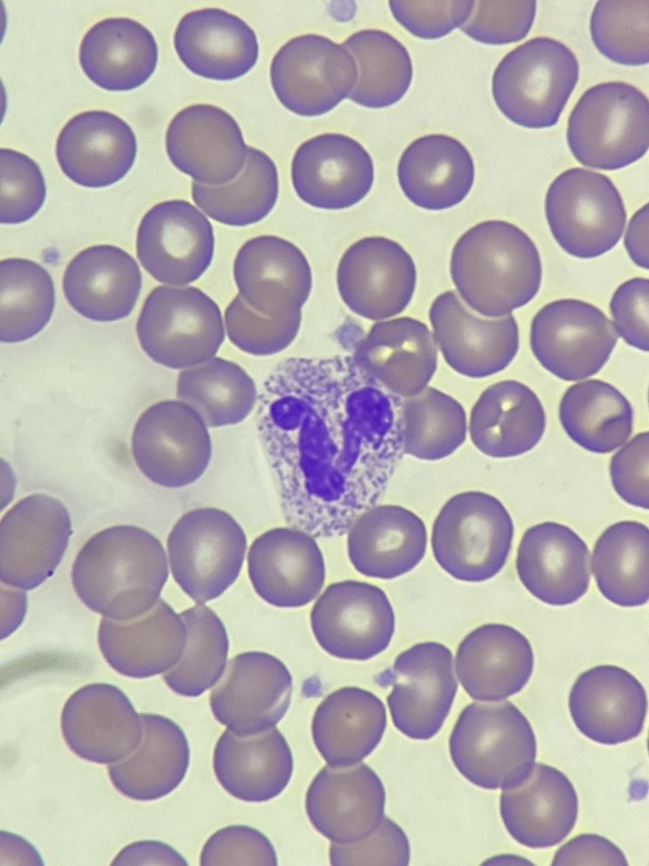 When #SKOL is your blood type